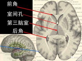 腦室 腦室